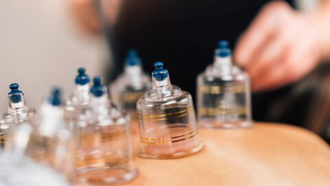 a physical therapist dressed in black is performing a cupping session in nebraksa.